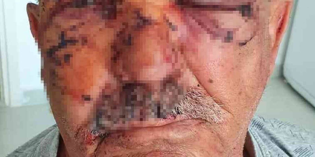 Beslediği komşusunun köpeğinin saldırısına uğradı