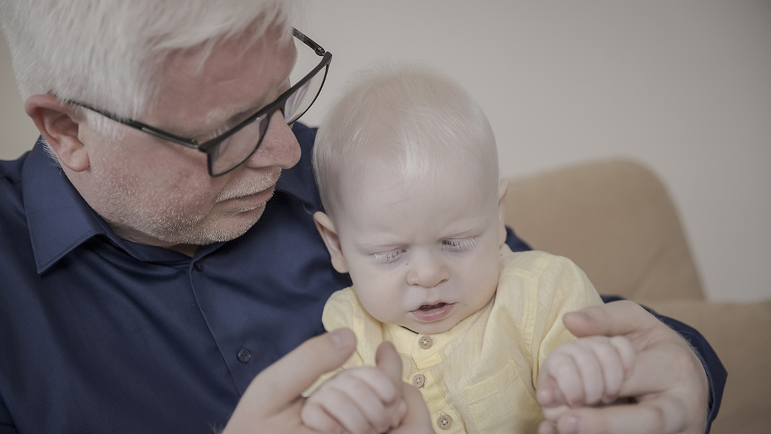 Kendileri gibi iki çocuklarıyla albinizmlilere örnek oluyorlar