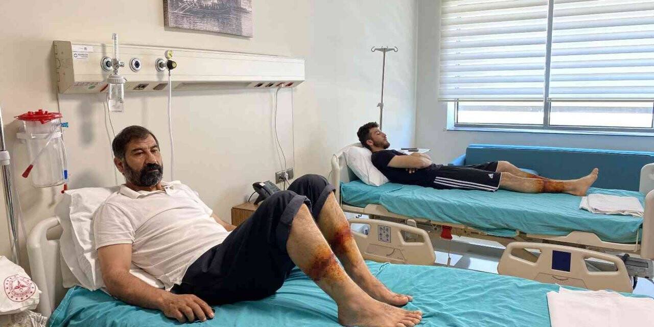 Bakırköy’deki inşaatta feci olay: Baba oğulun dizleri beton döktükleri sırada yandı