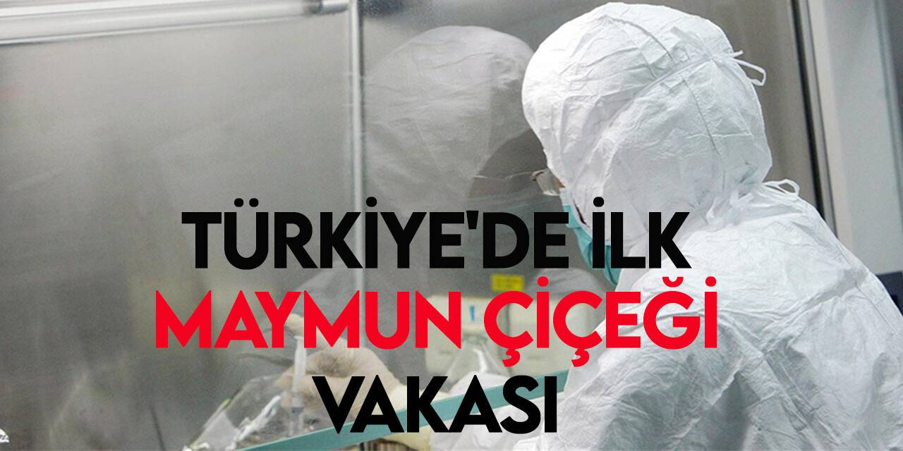Sağlık Bakanı Koca bir hastada maymun çiçeği hastalığı tespit edildiğini duyurdu