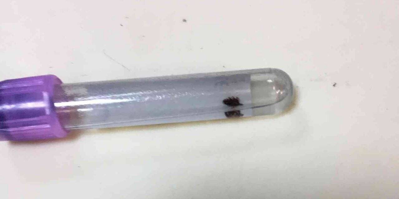 Vücuduna yapışan kene acil serviste çıkarıldı