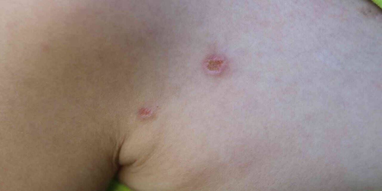 Babanın, oğlunun vücudunda sigara söndürdüğü iddia edildi