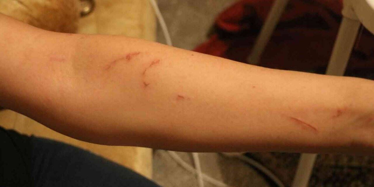 Diyarbakır’da iddiaya göre kiracı kadın ve engelli çocuğu ev sahibinin ailesi tarafından darp edildi