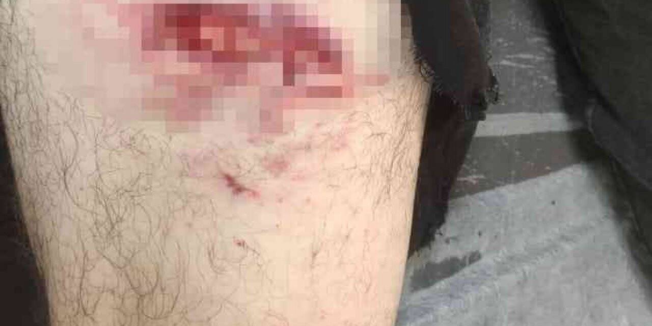 Köpek saldırısına uğrayan servis yetkilisi yaralandı