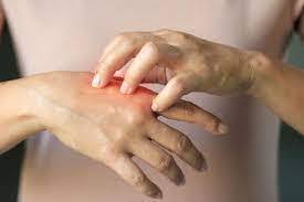 Sıcak havayla artan ‘kaşıntı’ şikâyetlerine karşı aktar önerileri