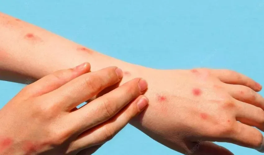 Uzmanından Hindistan'da görülen domates virüsüne karşı uyarı