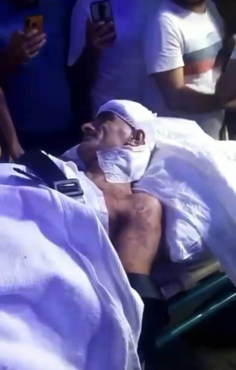 Bağcılar’da taksiciye saldırı: Fazladan istediği fişi vermeyen taksicinin boğazını kesti