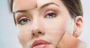 Cilt lekeleri uzman ellerde şifa buluyor