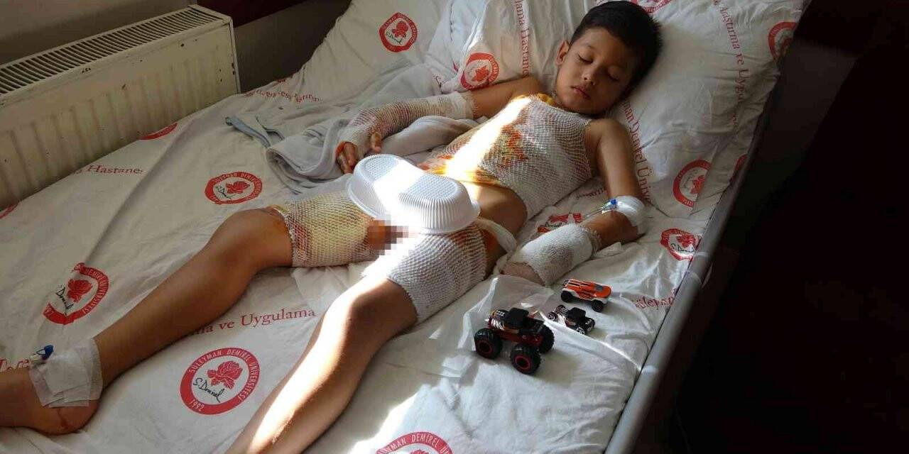 İlkokulda küçük Mehmet Ali’yi yakan turşu etkinliği