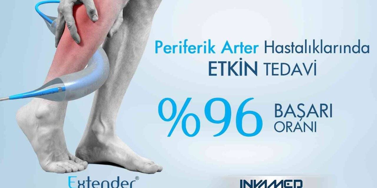 Bu yöntem periferik arter hastalığında yüzde 96 başarı sağlıyor
