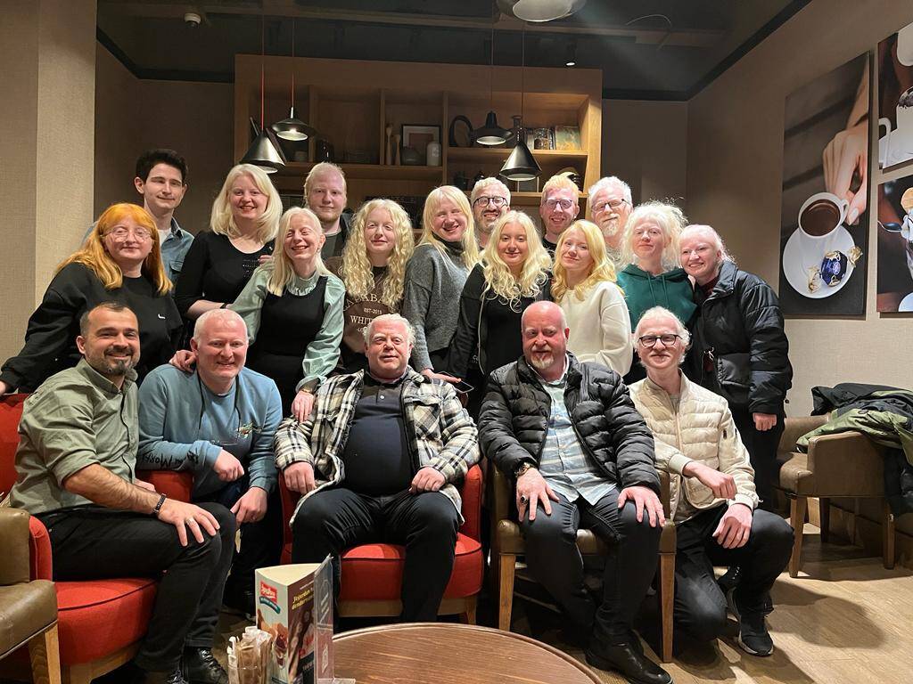 Ankara’da "Albinizmli Gençler Sahada" etkinliği düzenlendi!