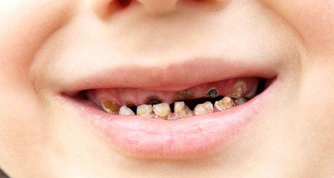 Çocukların eğitimini olumsuz etkileyebiliyor