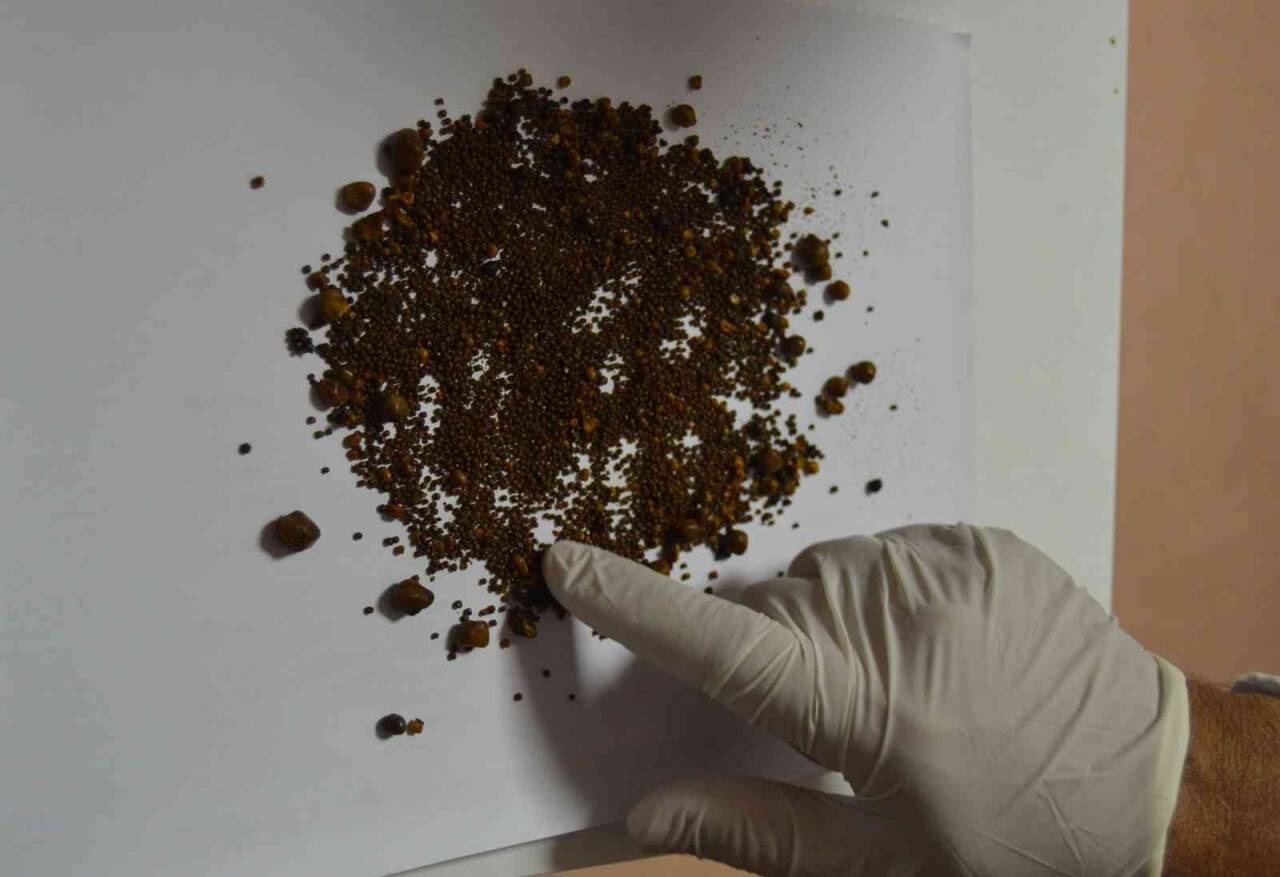 Safra kesesi değil sanki taş ocağı