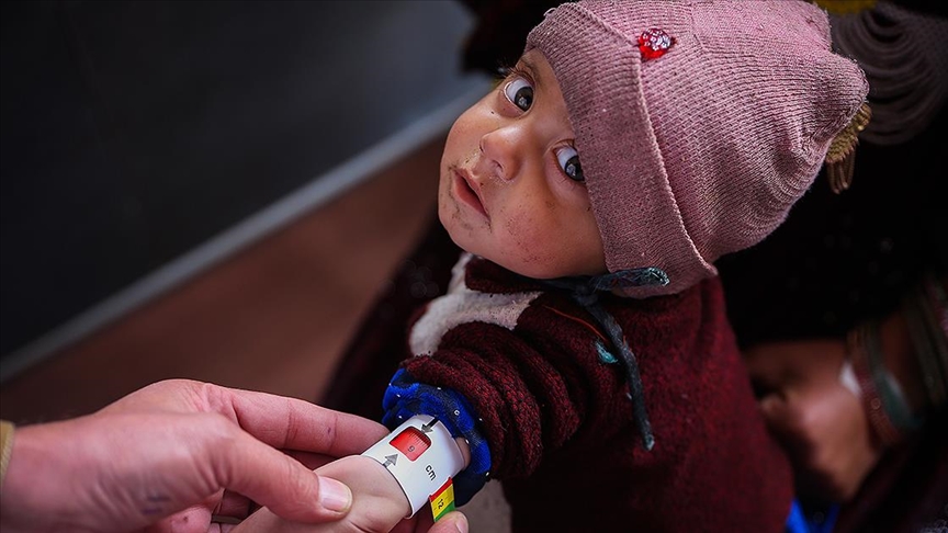 Sütten kesilen Afgan annelerin bebekleri büyüyemiyor