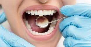 Diş hassasiyeti deyip geçmeyin