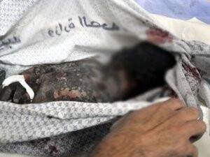 Şucaiyye Katliamında Ölü Sayı 72'ye Yükseldi