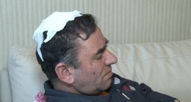 Davalı yeğeni kafa derisini yüzdü