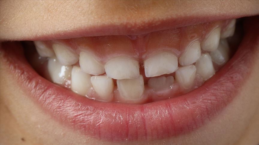 Diş kaybına etkili çözüm