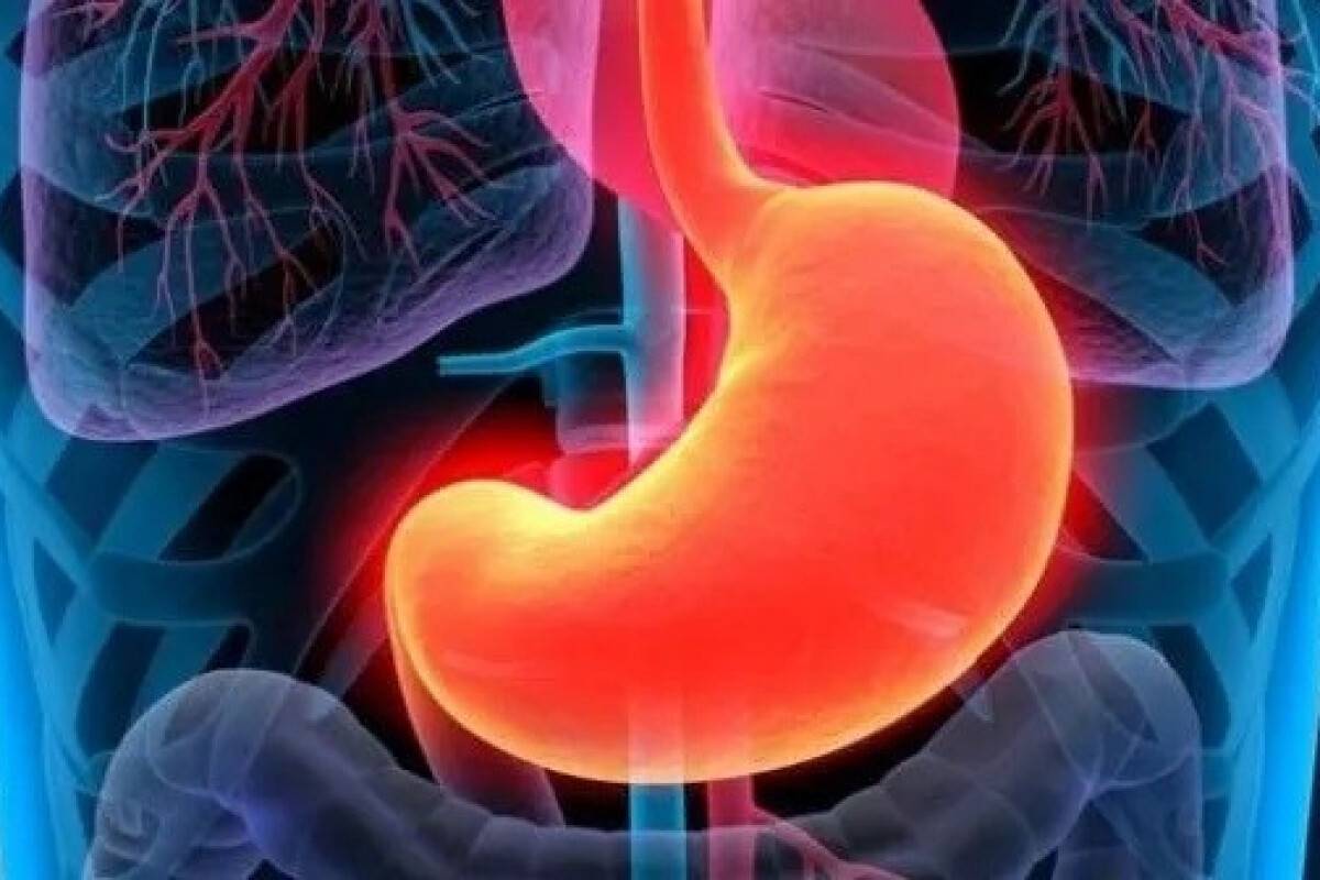 Uzmanından mide botoksu açıklaması: Doğru dozda yapılmalı