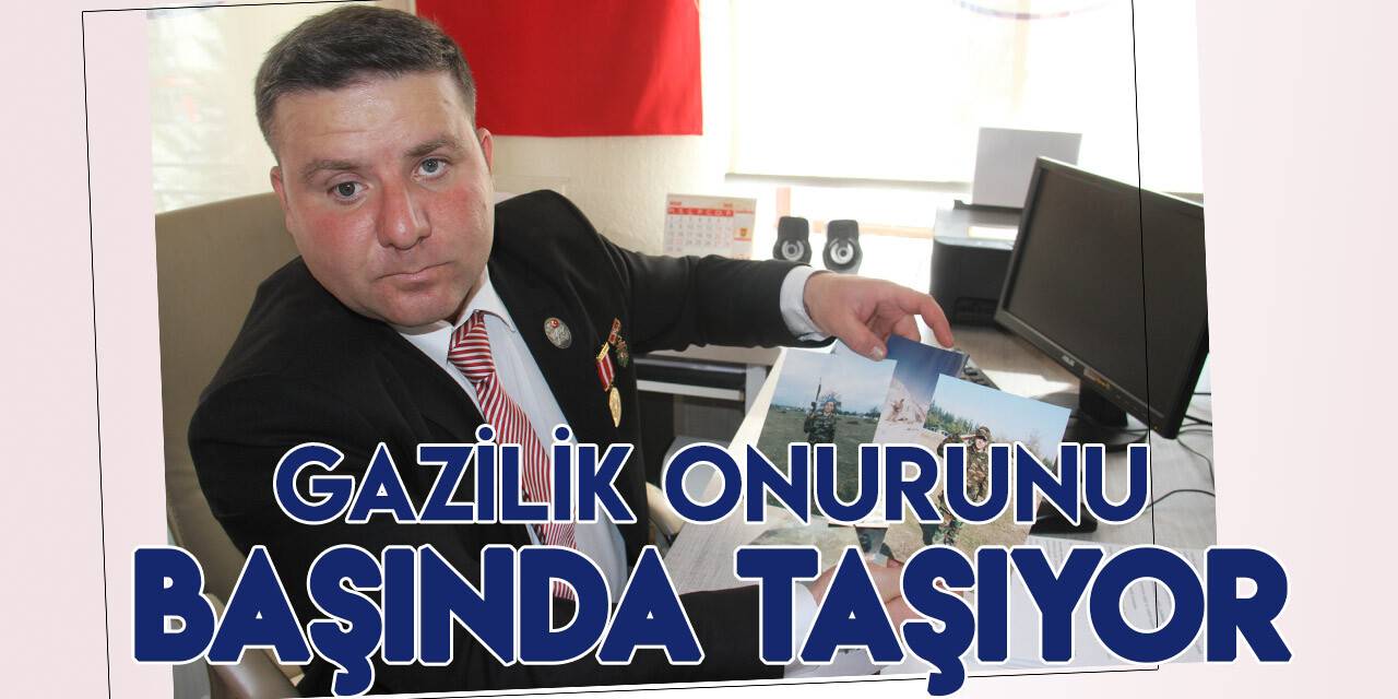 16 yıldır başındaki şarapnel parçasıyla yaşayan Konyalı gazi: Vatana canımız feda olsun