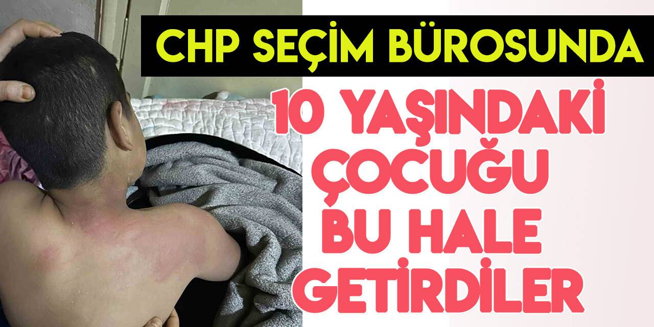 CHP seçim bürosunda 10 yaşındaki çocuğa kaynar çay fırlatıldı