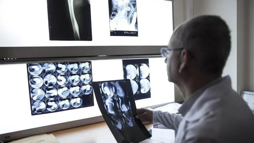 Nöroloji Uzmanı Doç. Dr. Büyükgöl: Epilepsi tanınız gerçek olmayabilir