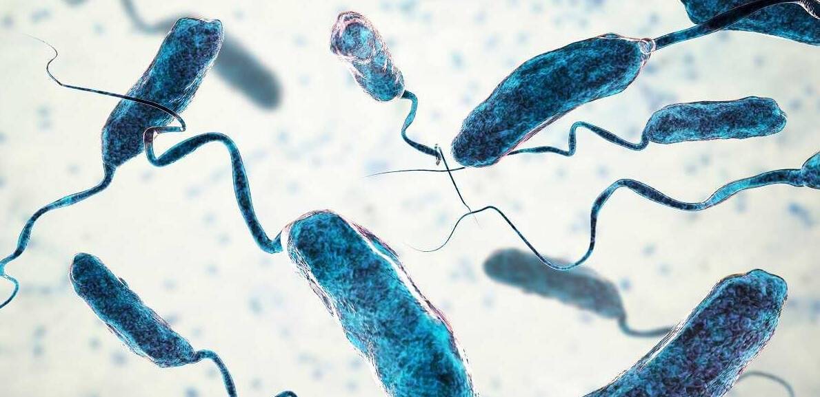 Kolera salgınında 426 kişi öldü