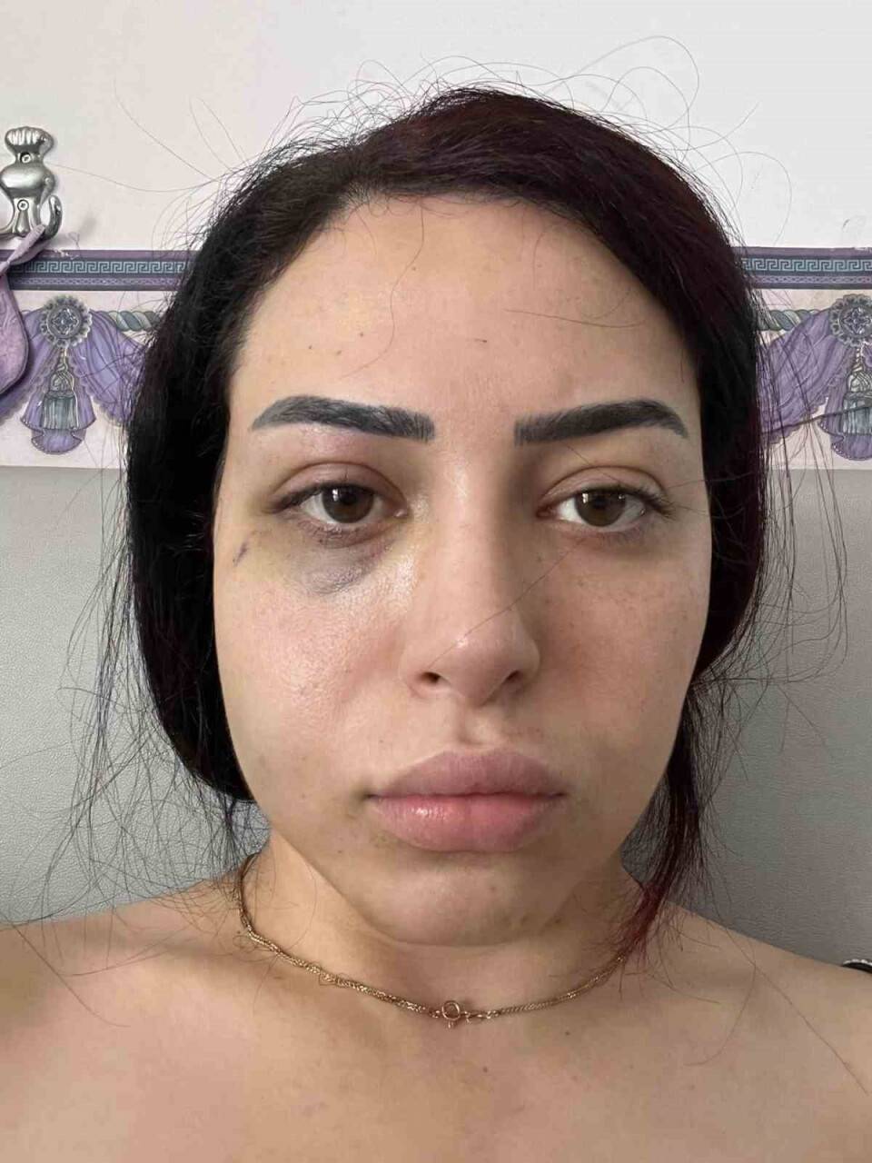 GKRY’de 25 yaşındaki Türk kızına saldıran 2 Rum tutuklandı