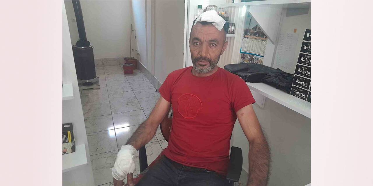 Dükkanının önünü yıkarken başına beton düştü