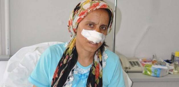 Eşi burnunu kesti, o affetti