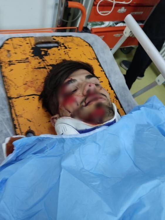 Ehliyetsiz sürücü polis aracına çarptı