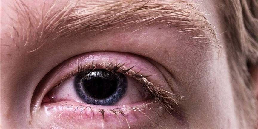 Klima kullanayım derken gözleriniz yaşarmasın