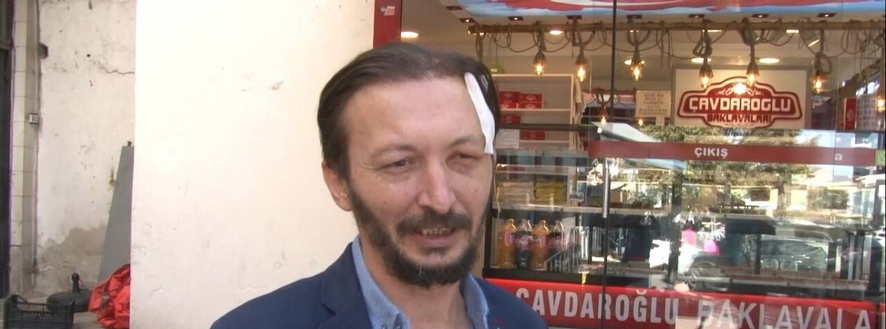 ‘Ne bakıyorsun’  kafasından bıçakladılar: 28 dikiş atıldı