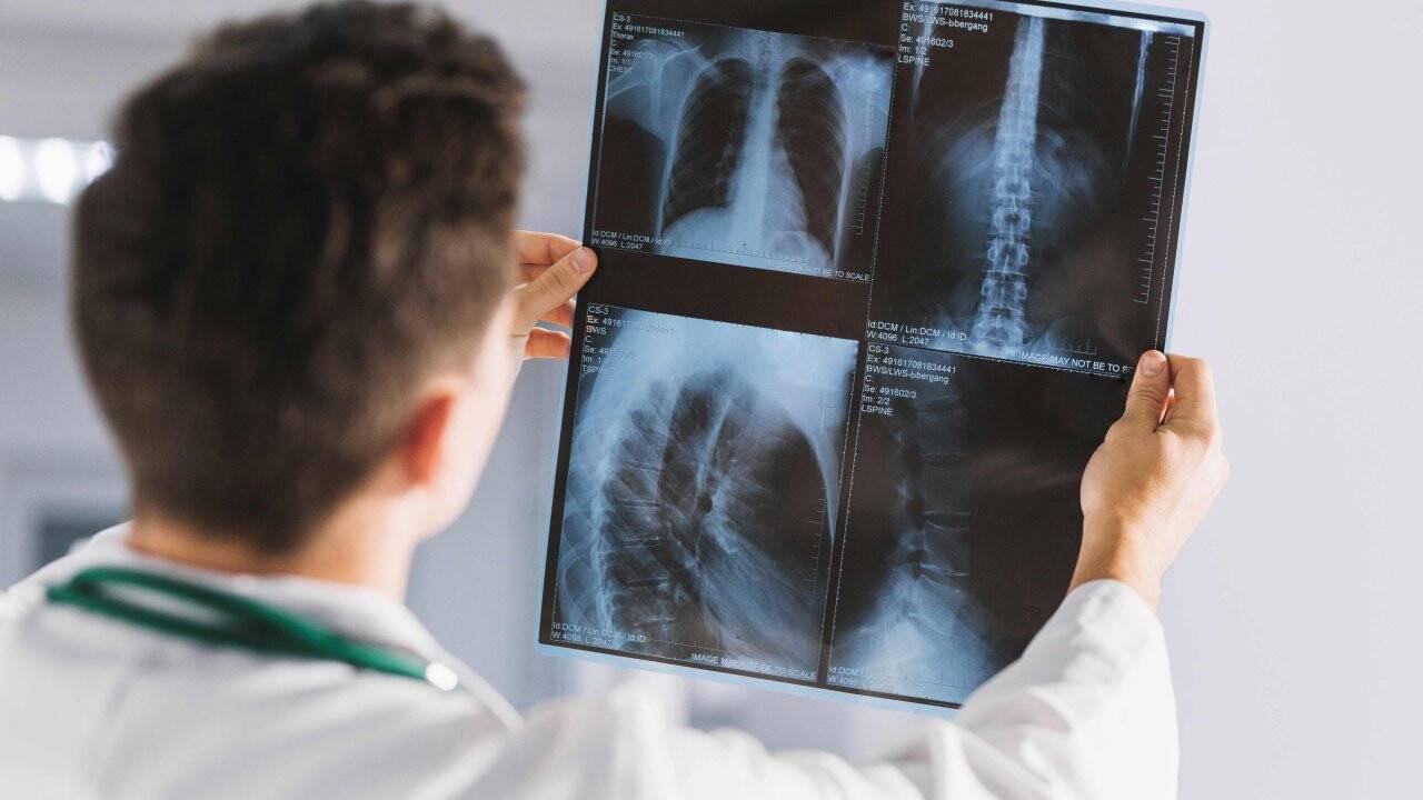 Radyasyonun olumsuz etkilerini azaltmak mümkün