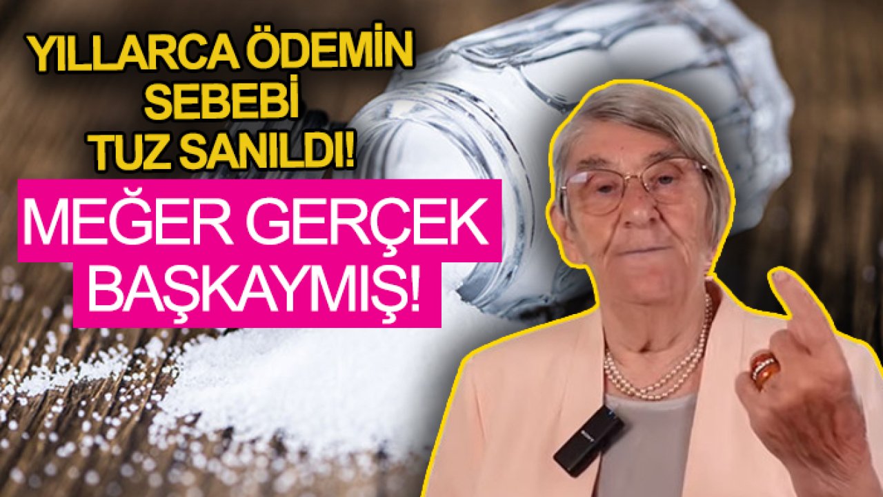 Canan Karatay ezber bozdu! Yıllarca ödemin sebebi tuz sanıldı! Meğer gerçek başkaymış!