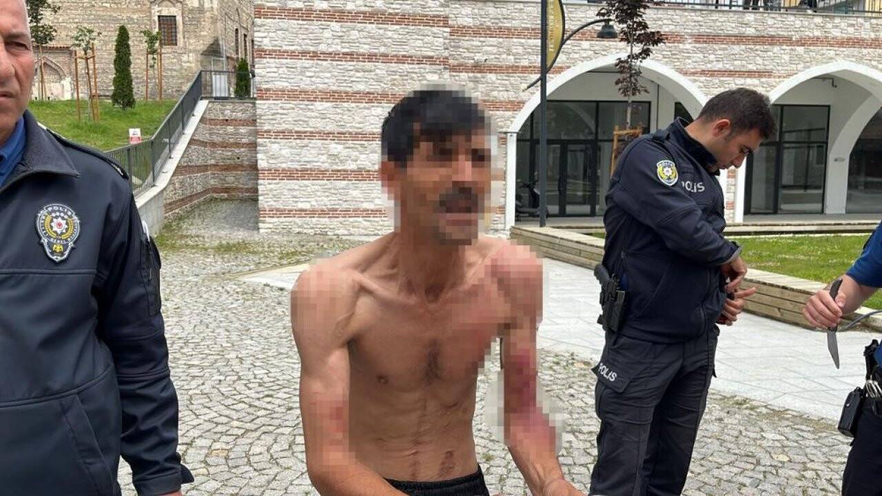 "7 çocuğum aç" diyerek kendini kesmişti, gerçek bambaşka çıktı