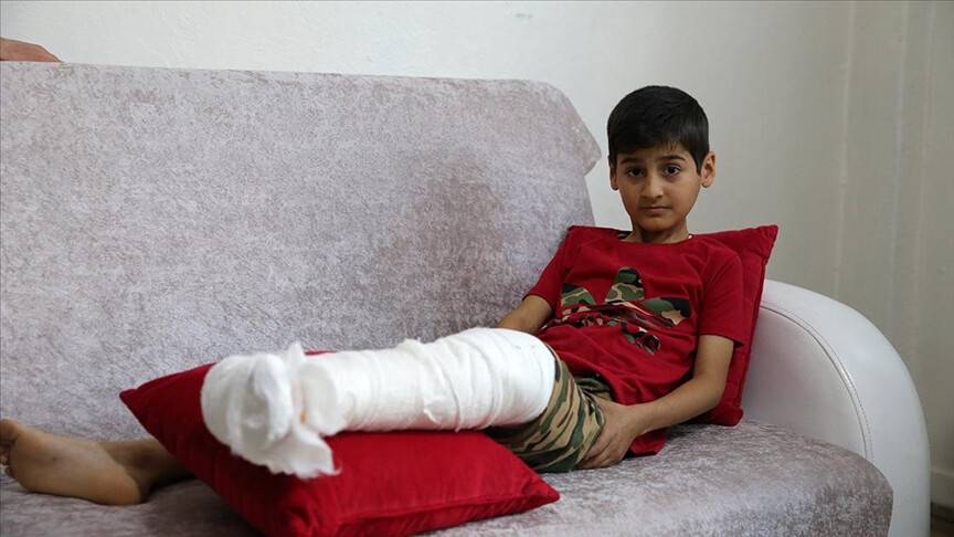 Sahipsiz köpekten kaçan çocuğun kaval kemiği kırıldı