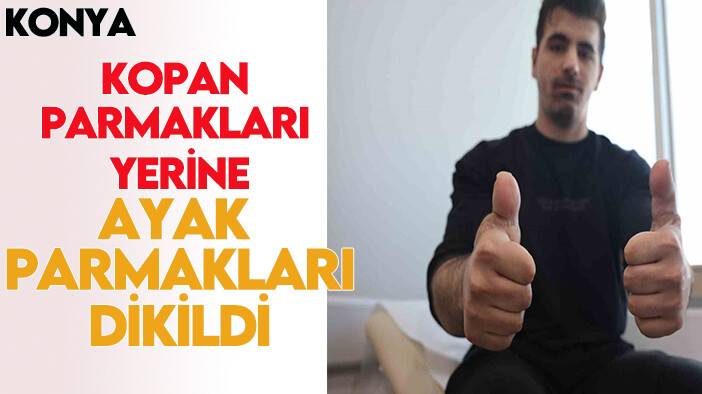 Konya'da kopan parmakları yerine ayak parmakları dikildi