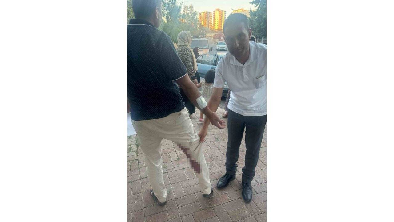 Şanlıurfa’da vatandaşı ısıran köpek kuduz çıktı