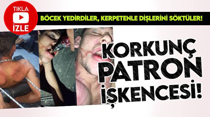 Patondalardan korkunç işkence: Böcek yedirdiler, kerpetenle dişlerini söktüler!