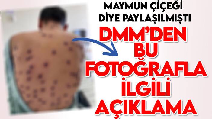 DMM'den o 'maymun çiçeği' paylaşımlarıyla ilgili açıklama