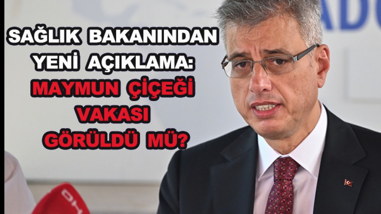 Sağlık Bakanından yeni açıklama: Maymun çiçeği vakası görüldü mü?