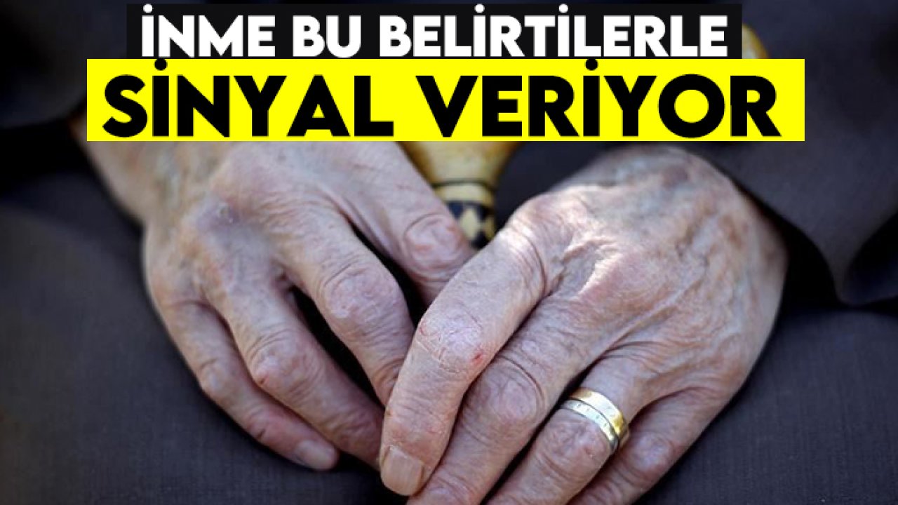 İnme bu belirtilerle sinyal veriyor