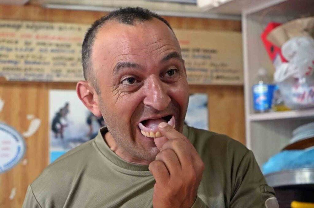 Takma dişini düşüren soluğu onun yanında alıyor