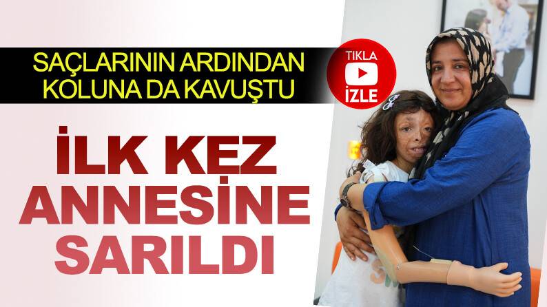 Annesine ilk kez sarıldı! Sinem saçlarından sonra protez koluna da kavuştu!