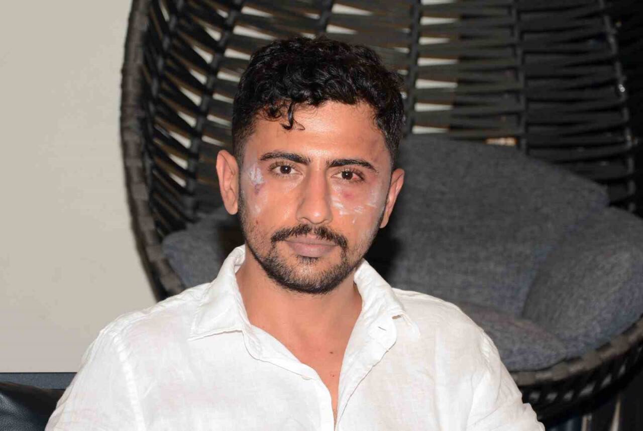 Diş hekimine muştalı  saldırı: Gerekçesi şoke etti