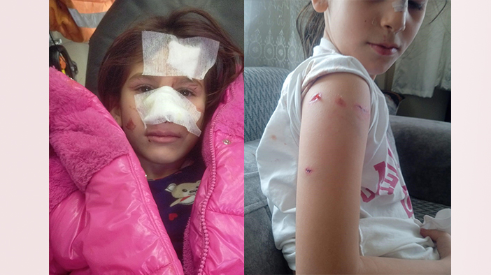 Okul bahçesinde köpek dehşeti: 5 öğrenciyi ısırdı