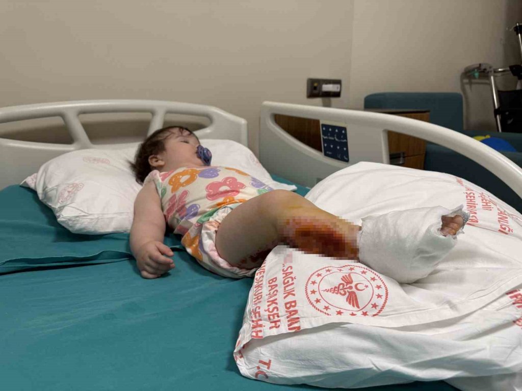 Üzerine çaydanlık devrilen bebek dehşeti yaşadı: Vücudunun yüzde 15’i yandı