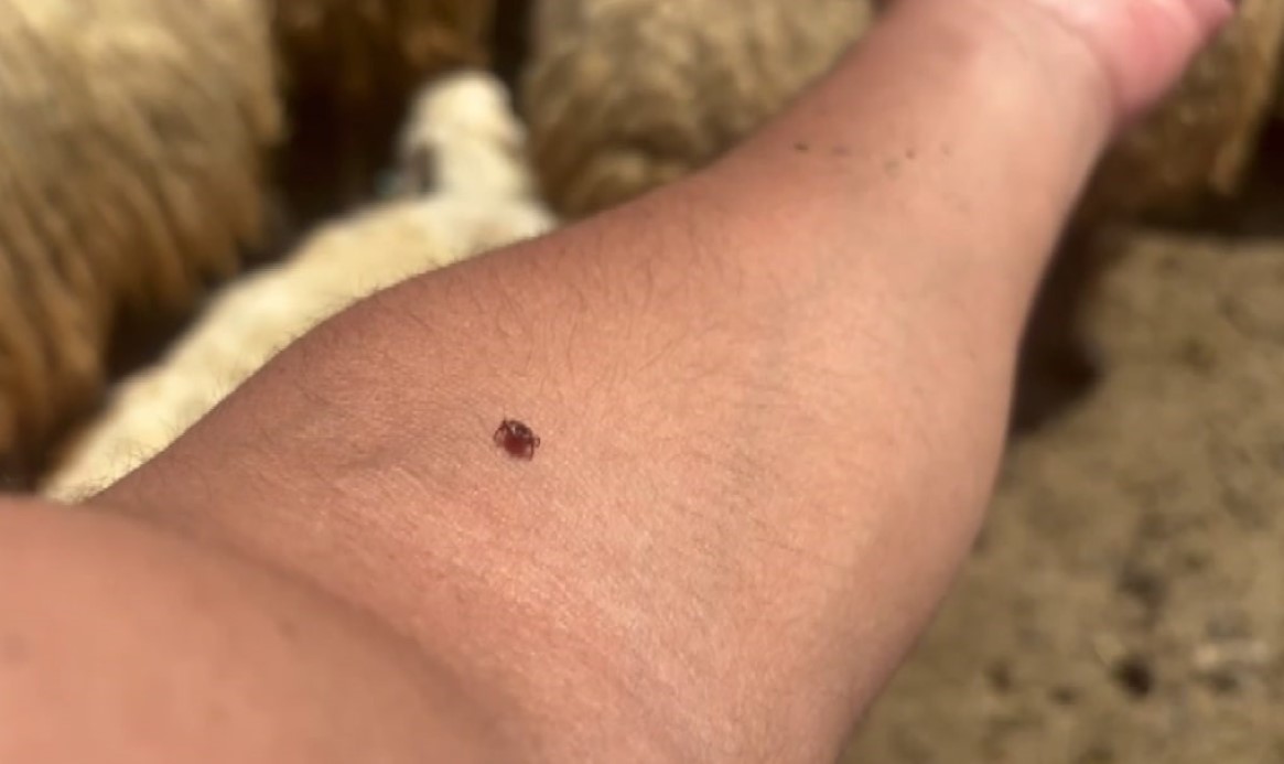 Kene tutundukça, hastalık riski artıyor: "Gerekirse kendiniz çıkarın"