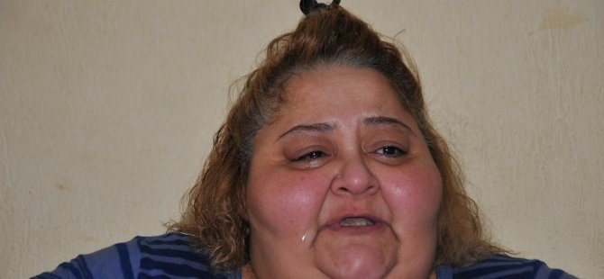 Obezite hastası kadının feryadı